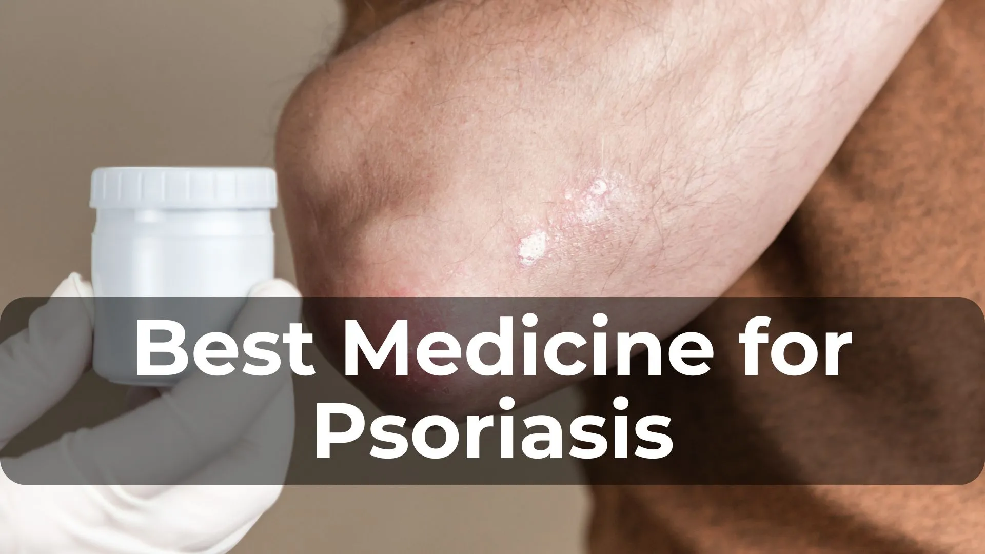 The Best Medicine for Psoriasis: What Works and What Doesn’t