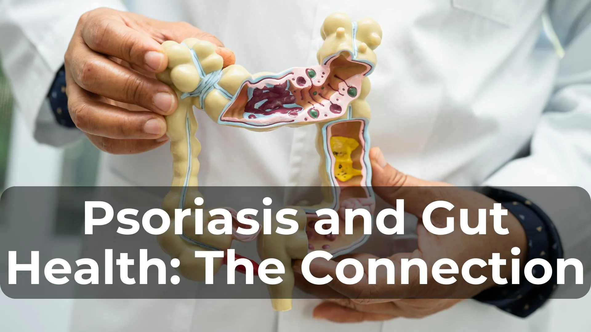 Psoriasis and Gut Health: The Connection You Need to Know