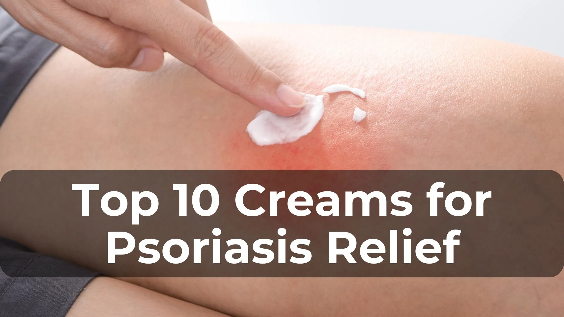 Top 10 Creams for Psoriasis Relief in 2024