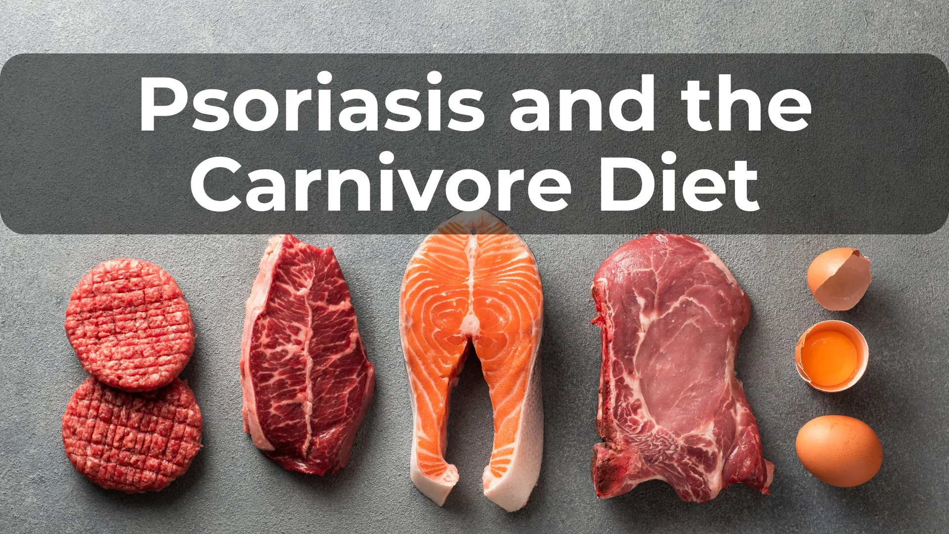 Psoriasis and the Carnivore Diet: A Personal Journey