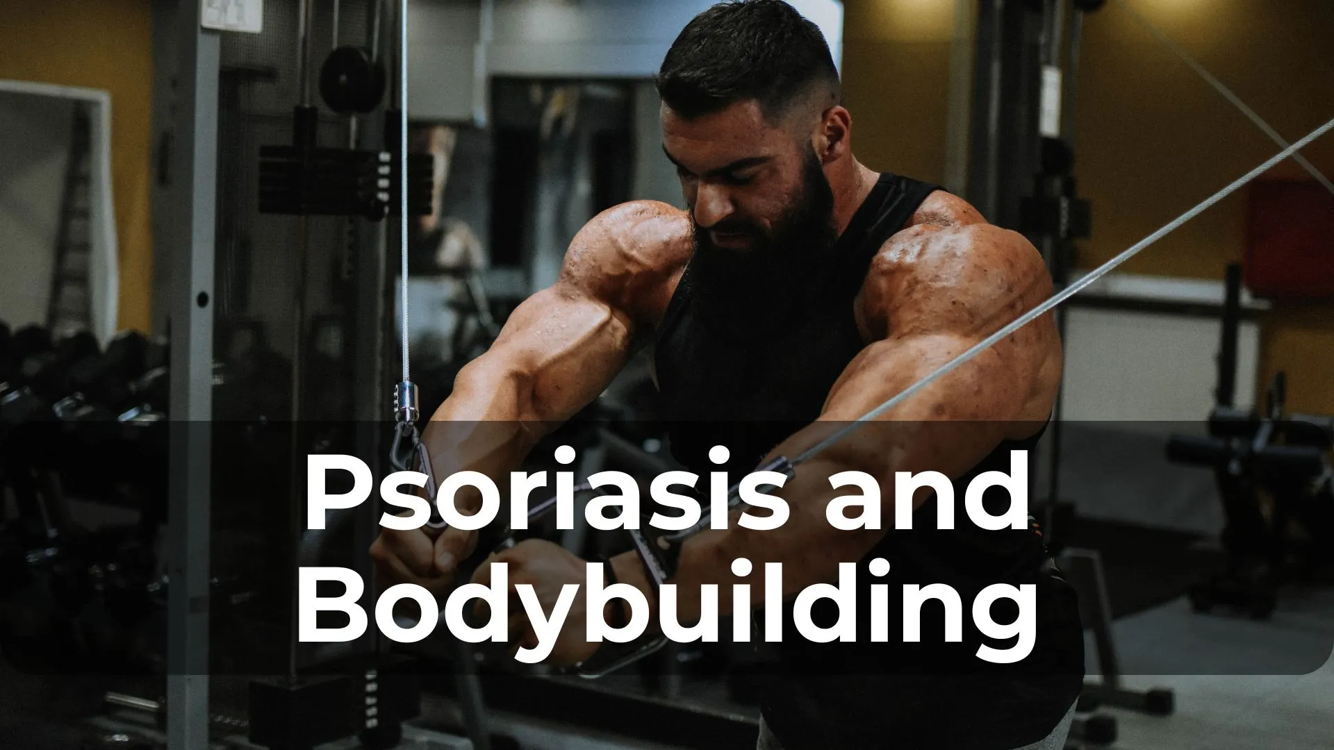 Psoriasis and Bodybuilding: Tips for Managing Your Condition