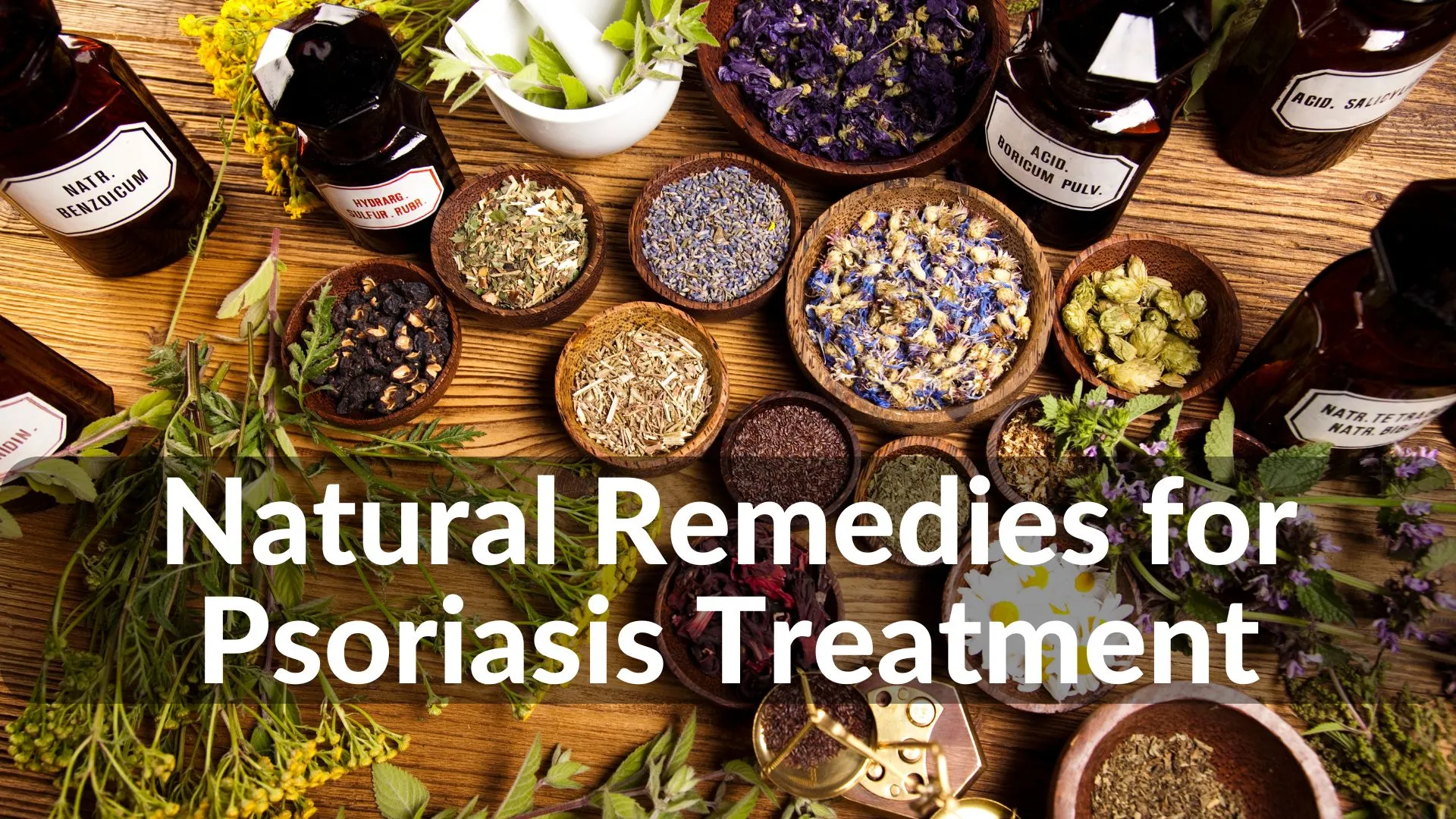 Best Natural Remedies for Psoriasis Treatment