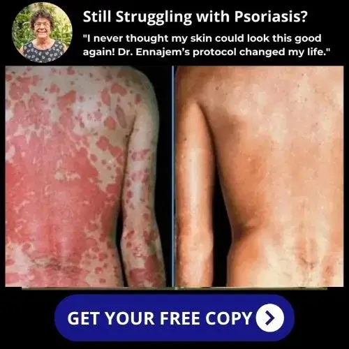 Psoriasis Freedom Protocol 1